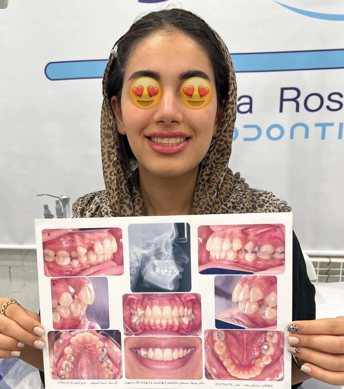 نمونه کار ارتودنسی دکتر شیما رستمی