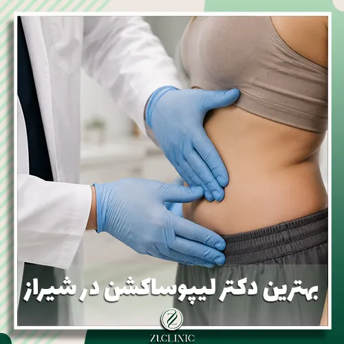 بهترین دکتر لیپوساکشن در شیراز