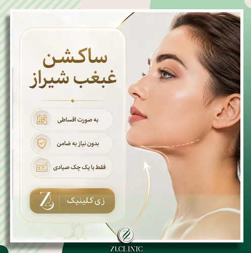 اینفوگرافی شرایط اقساط برای ساکشن غبغب در شیراز