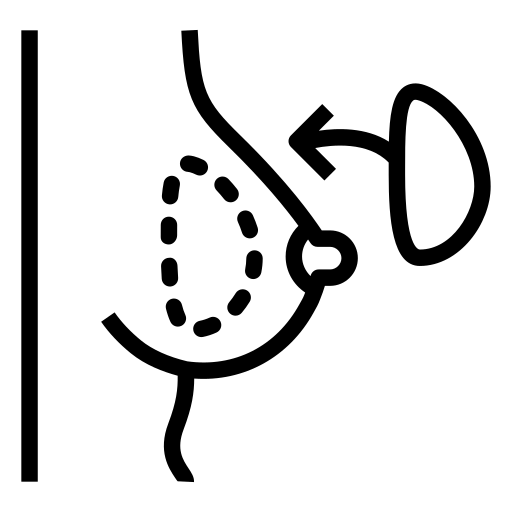 پروتز سینه